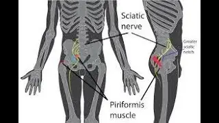 Sciatic Nerve Pain Exercises for Nerve Pain Relief using Nerve Renew
