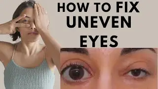 HOW TO CORRECT ASYMMETRICAL EYES | HOW TO CORRECT UNEVEN EYES | HOW TO FIX ASYMMETRICAL EYES & FACE