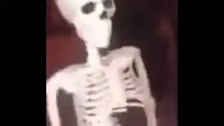 💀