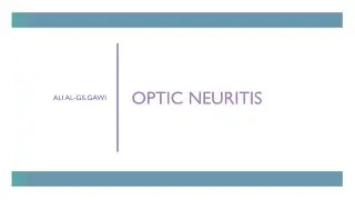 Optic Neuritis: Typical vs Atypical Causes