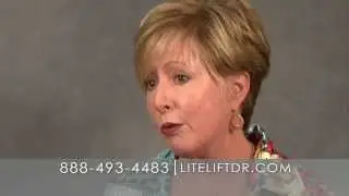 The LiteLift&trade;  A Modified Facelift - Patty