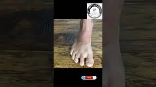 Foot strengthening exercises #physiotherapist9536 #viralvideo #shorts #footstrength
