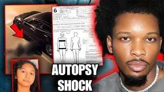 Medical Examiner Ka Shocking Reveal 😮 | Celeste AUTOPSY