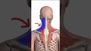 Voc&ecirc; sabia que ponto gatilhos podem gerar dor irradiada para outros locais?! 🤔