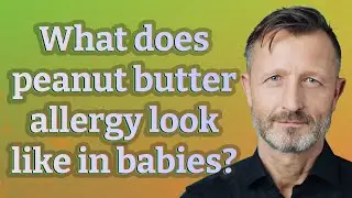 What does peanut butter allergy look like in babies?