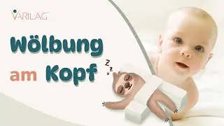 Wölbung (Beule) am Babykopf? Keine Panik! Korrekturprozess der Lagerungstherapie bei Kopfverformung.