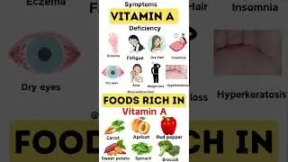 Night Blindness & Vitamin A Deficiency | Eye Health Tips by My Health by Dr Mohsin