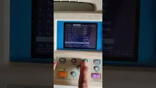 Veterinary Electrocardiography Machine (3 Channel) #ecg #trending #innovation #video #viral #youtube