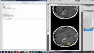Dr Eye - Export DICOM dataset to a MetaImage Raw file