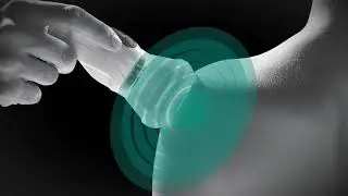 ASAlaser | MiS - MLS® HIGH PEAK PULSE