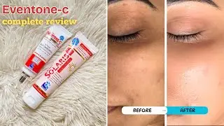 Eventone C whitening cream *HONEST REVIEW* Best Whitening Cream ?