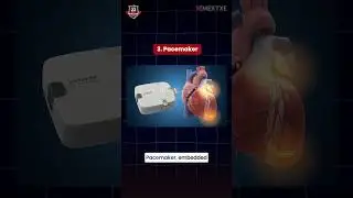Искусственный интеллект против встроенных систем? На самом деле это встроенные системы + ИИ.
