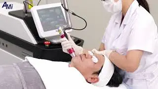 AMI Q MASTER Soft peel fine wrinkle