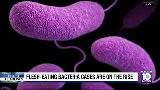 CDC reports rising cases of flesh-eating bacteria