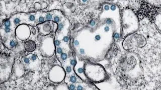 Coronavirus in Michigan: New cases, exposure locations, more about patients