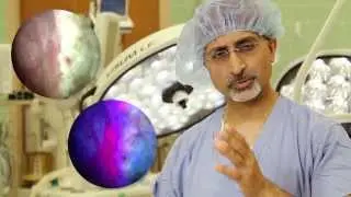 Fluorescent Cystoscopy