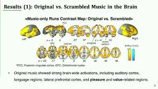 OHBM 2025 | Oral Session | Eui-Jin Jung | Music-Induced Analgesia in the Brain
