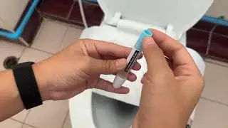 การตรวจคัดกรองมะเร็งลำไส้ใหญ่ด้วย FIT (Fecal Immunochemical Test)