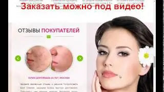 Active cleaner anti spot gel