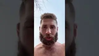 Jiri Prochazka shows his ugly foot