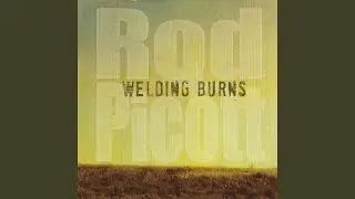 Welding Burns