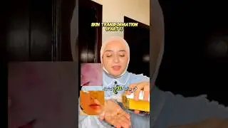 تحدي 30 يوم لبشرة صافية ✨ | اوعدك بشرتك هتتغير لو التزمتي بالتحدي ده💪🏻