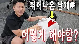 튀어나온 날개뼈(견갑골) 성능 확실한 익상견갑 교정운동