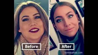 Weight Loss   Incredible Face Transformation
