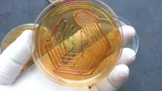 Cryptococcus neoformans growth on SDA , BSA urea hydrolization Positive