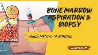 Bone marrow aspiration and biopsy procedure #nurseeducator-15p#nursesnotes #bonemarrowaspiration