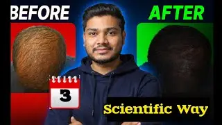 3 MINUTES to STOP Hair Fall FOREVER