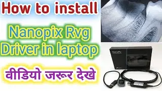 How to install Nanopix Rvg Driver in laptop/Dental bharat