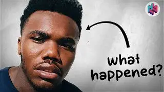 WTF Happened To Baby Keem? (5 Years Later..)