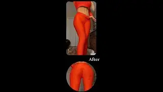 Liposuction & BBL by Dr. Constantino Mendieta
