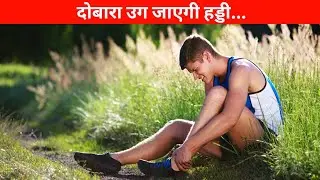 पूरी तरह गायब हड्डी भी दोबारा उग जाएगी | bone fracture repair kit ||