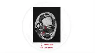 CASE OF THE WEEK I When trauma + infection leave behind more than just a scar&hellip; Part 2