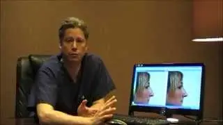 Benefits of Video Imaging explained by Dr. Mark Hamilton