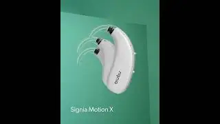 Motion X: dispositivos com suporte cont&iacute;nuo de assistente virtual #Shorts