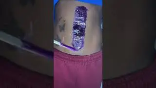 Stomach Waxing with Sexy Smooth Purple Seduction Hard Wax | TN Travel Esthetician