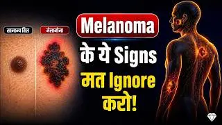 Melanoma Cancer कैसे होता है? | How Does Melanoma Cancer Develop? | Dr. Megha Chaturvedi