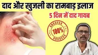 daad ki dawa|| daad ka ilaj || daad kaise theek kare|| home remedies for fungal infection