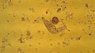 Rotifer Feeding