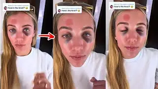 New Footage Reveals Lexie Hull&rsquo;s Head Injury Was Downplayed BIG Time...