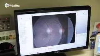 Dr. Dawson T. Li - Digital Retinal Camera