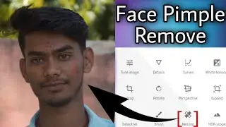Face Pimple remove+Full Totorial #RGM #Editing