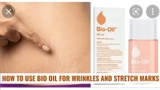 DO REALLY BIO OIL WORK . REVIEW AND RATING ABOUT BIO OIL .