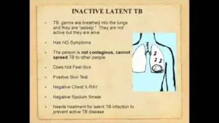 TBFacts