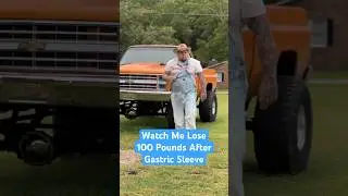 Watch Me Lose 100 Pounds After Gastric Sleeve ️&zwj;🔥