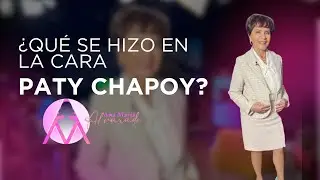 QUÉ SE HIZO EN LA CARA PATY CHAPOY ¡?
