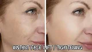 FULL FACE LIFTING | full Face TIGHTNING | (1X MAX) 